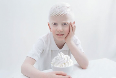 13 июня в мире отмечается Международный день распространения информации об альбинизме (International Albinism Awareness Day)