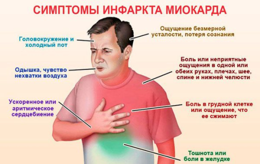 Инфаркт: признаки и симптомы