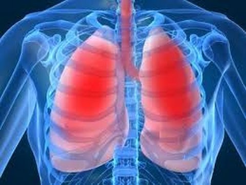  Что такое туберкулез? 