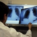 Пресс – релиз проведения месячника по профилактике туберкулеза с 24 февраля – 23 марта и приуроченного к нему Всемирного дня борьбы с туберкулезом (24 марта)